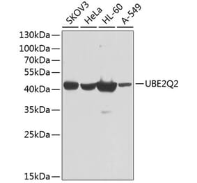 Western Blot - Anti-UBE2Q2 Antibody (A10857) - Antibodies.com