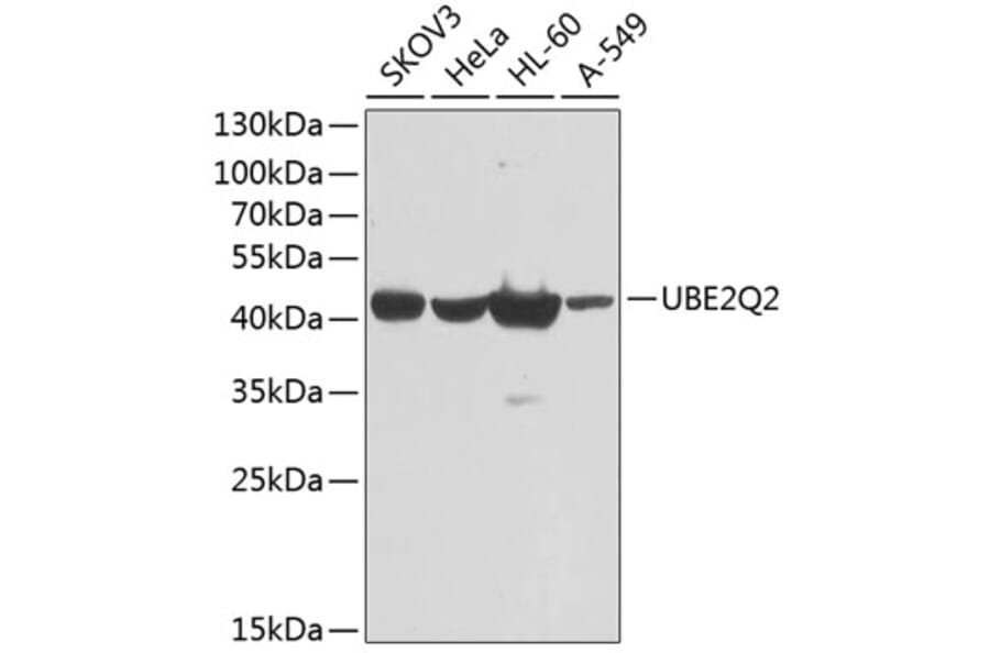 Western Blot - Anti-UBE2Q2 Antibody (A10857) - Antibodies.com