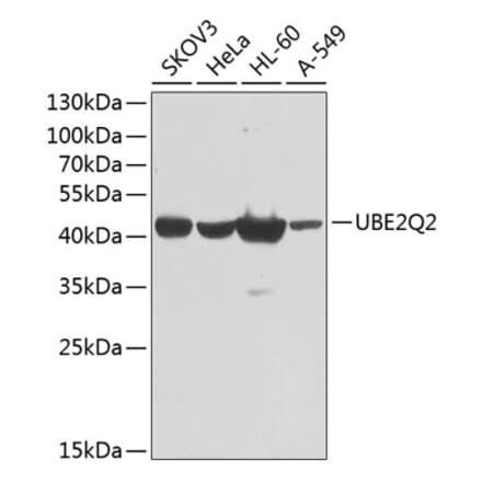 Western Blot - Anti-UBE2Q2 Antibody (A10857) - Antibodies.com