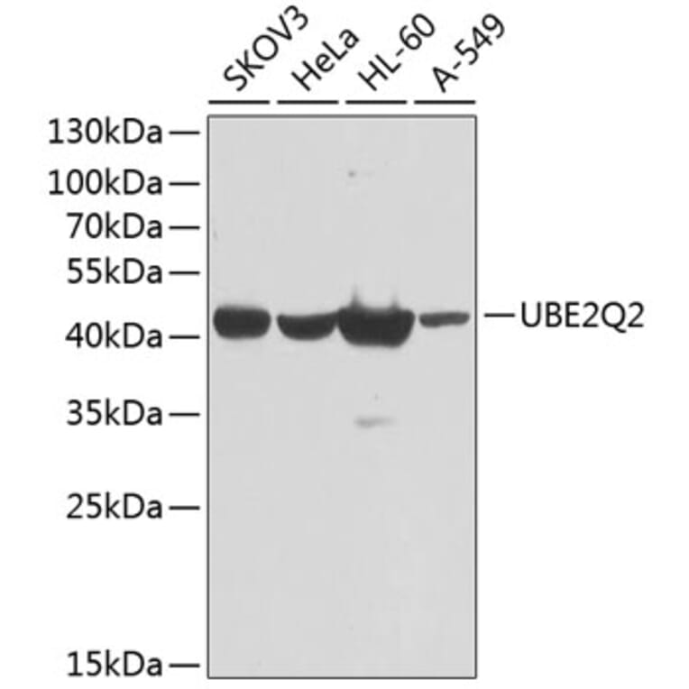 Western Blot - Anti-UBE2Q2 Antibody (A10857) - Antibodies.com