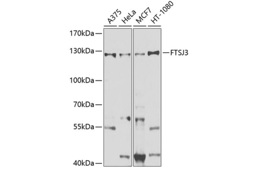 Western Blot - Anti-FTSJ3 Antibody (A10858) - Antibodies.com