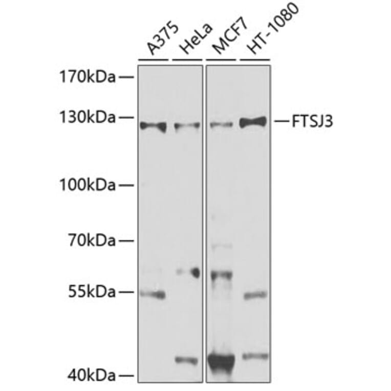 Western Blot - Anti-FTSJ3 Antibody (A10858) - Antibodies.com