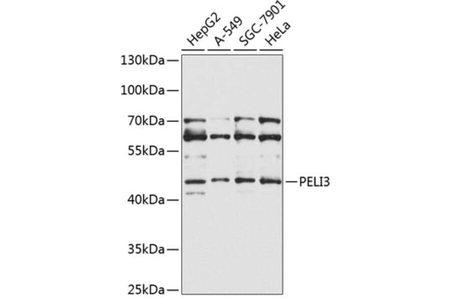 Western Blot - Anti-PELI3 Antibody (A10860) - Antibodies.com