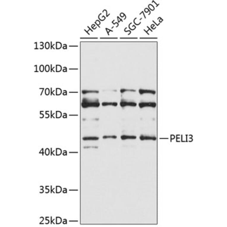 Western Blot - Anti-PELI3 Antibody (A10860) - Antibodies.com