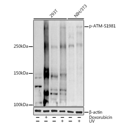 Western Blot - Anti-ATM (phospho Ser1981) Antibody (A10862) - Antibodies.com