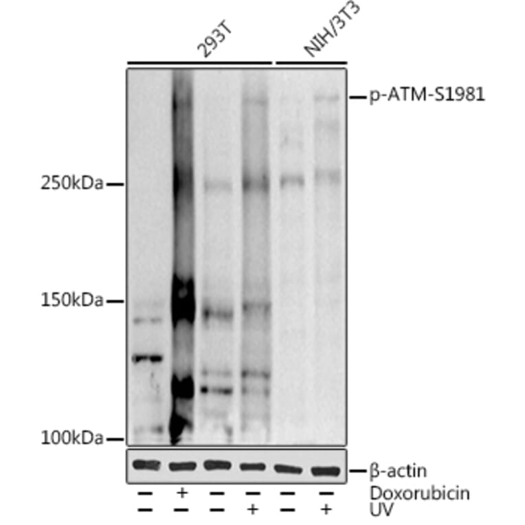 Western Blot - Anti-ATM (phospho Ser1981) Antibody (A10862) - Antibodies.com