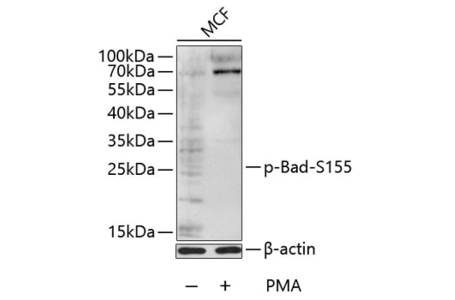 Western Blot - Anti-Bad (phospho S155) Antibody (AP0009) - Antibodies.com