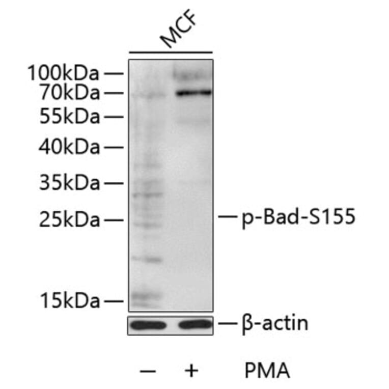 Western Blot - Anti-Bad (phospho S155) Antibody (AP0009) - Antibodies.com