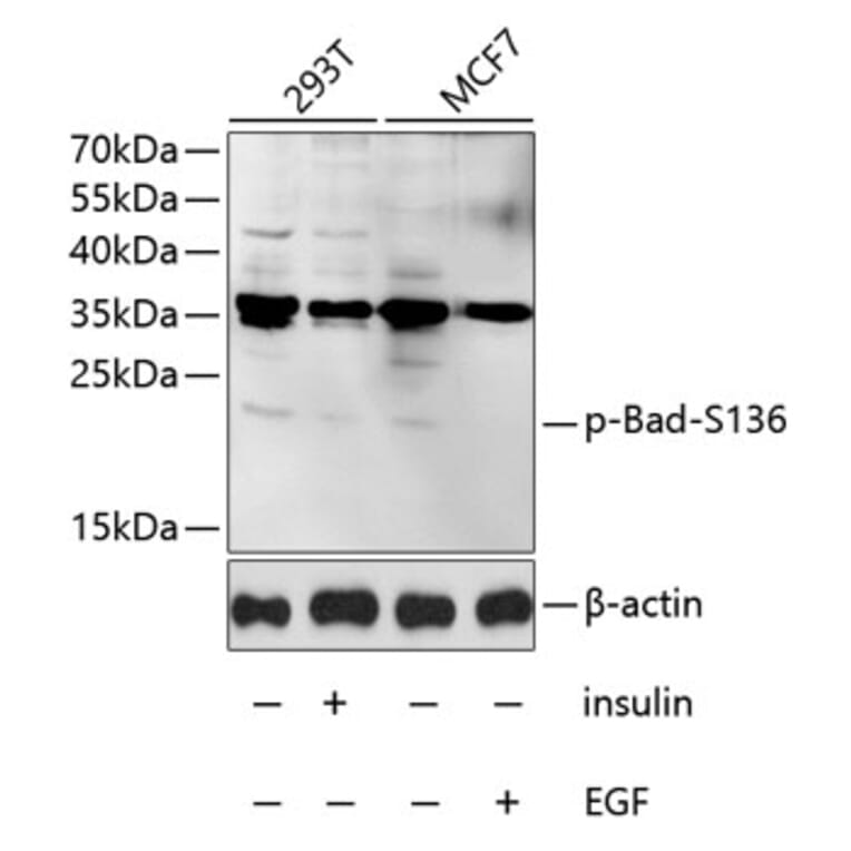 Western Blot - Anti-Bad (phospho S136) Antibody (AP0011) - Antibodies.com