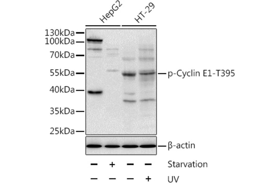 Western Blot - Anti-Cyclin E1 (phospho Thr395) Antibody (A10865) - Antibodies.com
