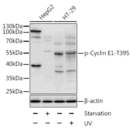 Western Blot - Anti-Cyclin E1 (phospho Thr395) Antibody (A10865) - Antibodies.com