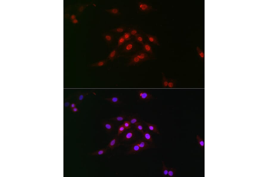 Immunofluorescence - Anti-Cyclin E1 (phospho Thr395) Antibody (A10865) - Antibodies.com