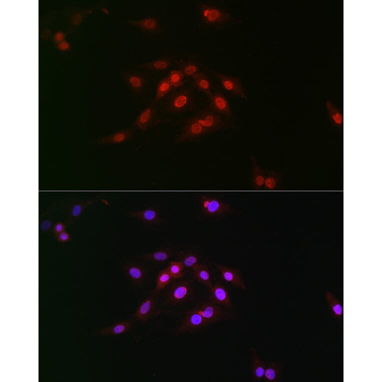 Immunofluorescence - Anti-Cyclin E1 (phospho Thr395) Antibody (A10865) - Antibodies.com