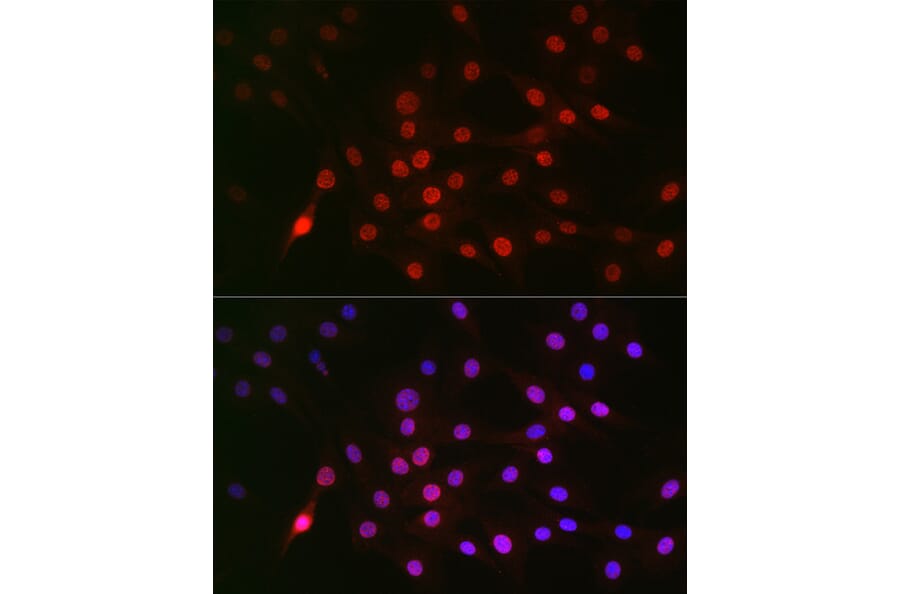 Immunofluorescence - Anti-Cyclin E1 (phospho Thr395) Antibody (A10865) - Antibodies.com