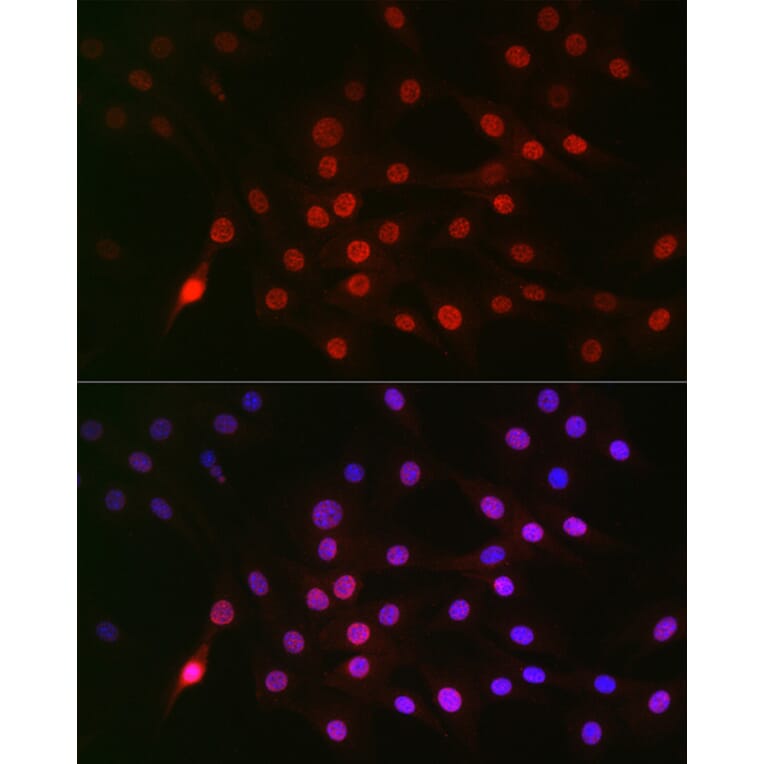 Immunofluorescence - Anti-Cyclin E1 (phospho Thr395) Antibody (A10865) - Antibodies.com