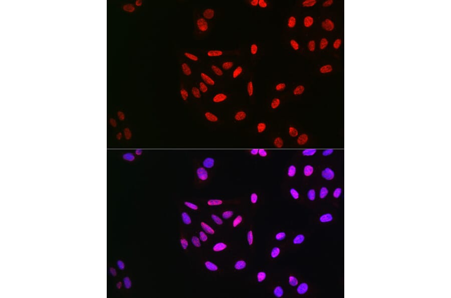 Immunofluorescence - Anti-Cyclin E1 (phospho Thr395) Antibody (A10865) - Antibodies.com