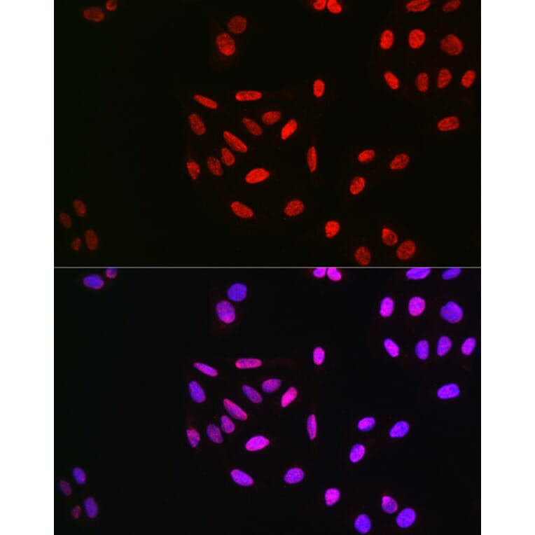 Immunofluorescence - Anti-Cyclin E1 (phospho Thr395) Antibody (A10865) - Antibodies.com