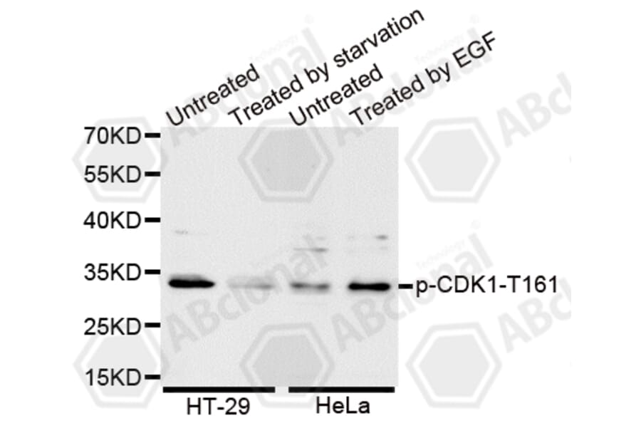 Western Blot - Anti-Phospho-CDK1-T161 Antibody (AP0014) - Antibodies.com