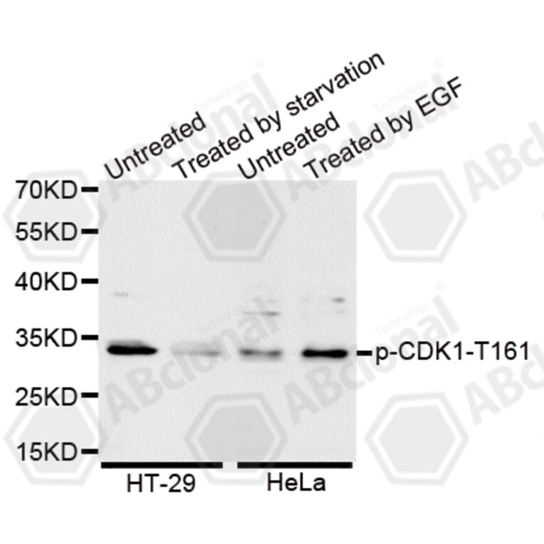 Western Blot - Anti-Phospho-CDK1-T161 Antibody (AP0014) - Antibodies.com
