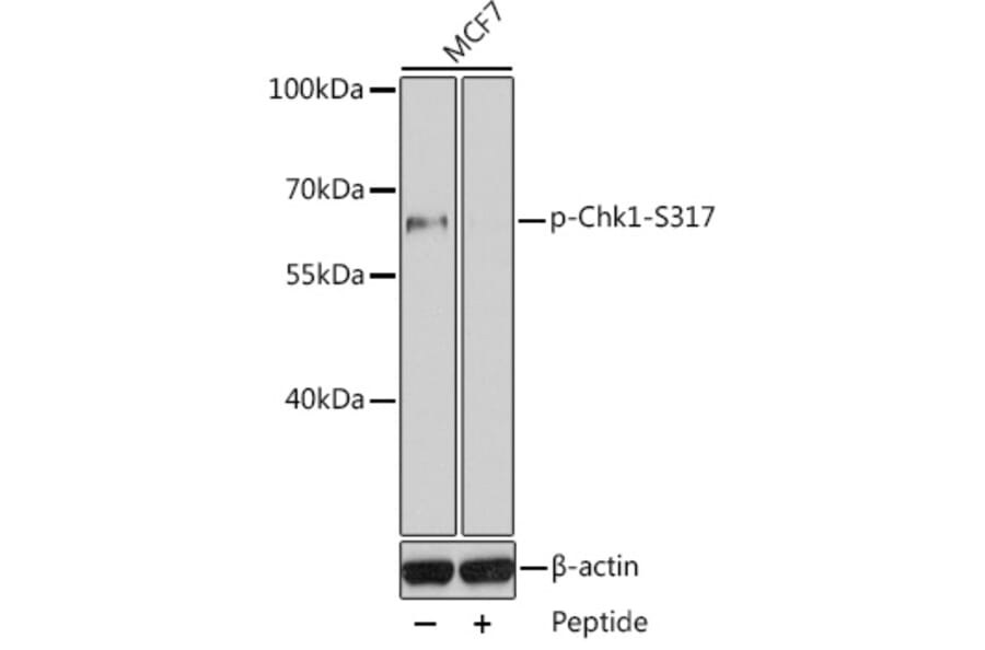Western Blot - Anti-Chk1 (phospho Ser317) Antibody (A10867) - Antibodies.com