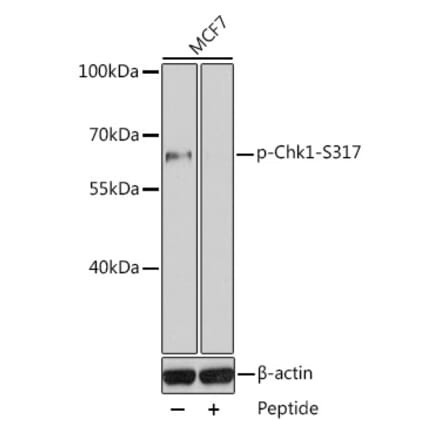 Western Blot - Anti-Chk1 (phospho Ser317) Antibody (A10867) - Antibodies.com
