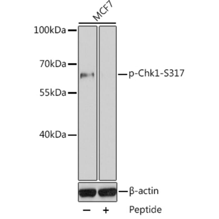 Western Blot - Anti-Chk1 (phospho Ser317) Antibody (A10867) - Antibodies.com