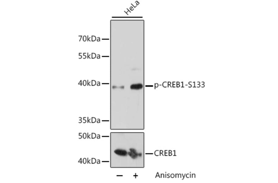 Western Blot - Anti-CREB (phospho Ser133) Antibody (A10868) - Antibodies.com