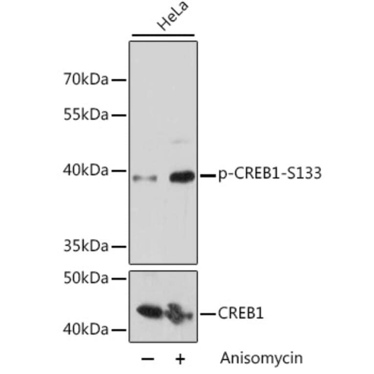 Western Blot - Anti-CREB (phospho Ser133) Antibody (A10868) - Antibodies.com