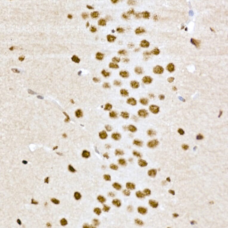 Immunohistochemistry - Anti-CREB (phospho Ser133) Antibody (A10868) - Antibodies.com