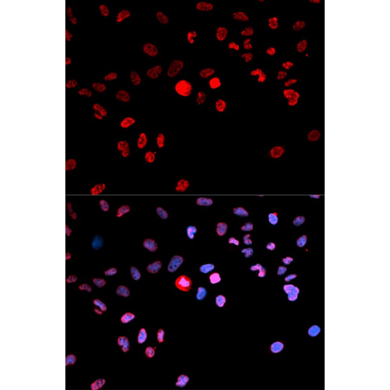 Immunofluorescence - Anti-CREB (phospho Ser133) Antibody (A10868) - Antibodies.com