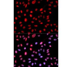 Immunofluorescence - Anti-Dnmt1 (phospho Ser714) Antibody (A10869) - Antibodies.com