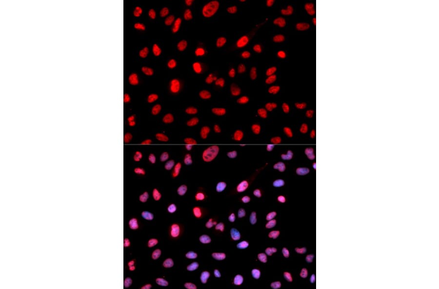 Immunofluorescence - Anti-Dnmt1 (phospho Ser714) Antibody (A10869) - Antibodies.com