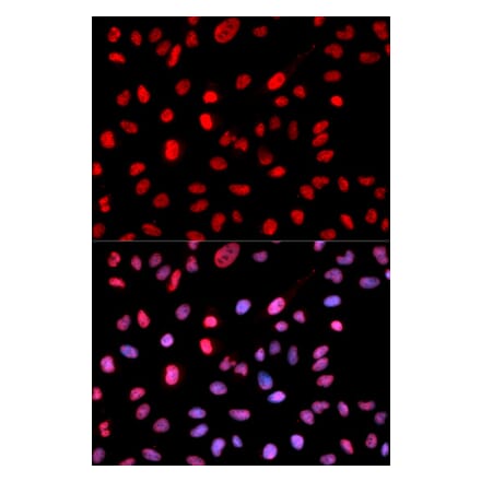 Immunofluorescence - Anti-Dnmt1 (phospho Ser714) Antibody (A10869) - Antibodies.com