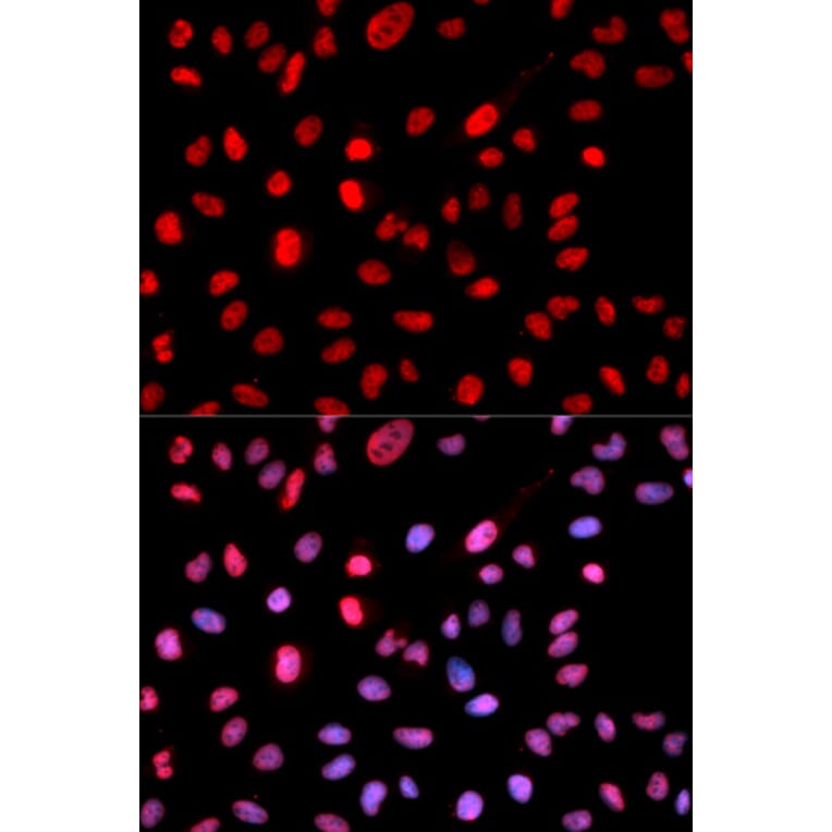 Immunofluorescence - Anti-Dnmt1 (phospho Ser714) Antibody (A10869) - Antibodies.com