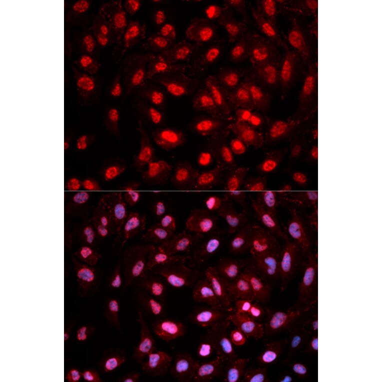 Immunofluorescence - Anti-Dnmt1 (phospho pY399) Antibody (AP0022) - Antibodies.com