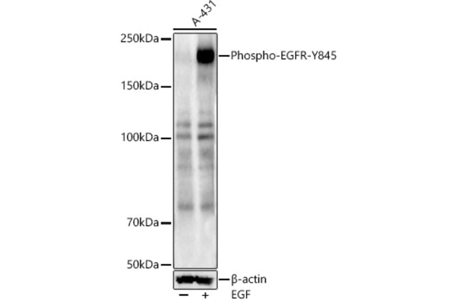 Western Blot - Anti-EGFR (phospho Tyr845) Antibody (A10871) - Antibodies.com