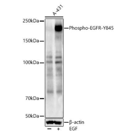 Western Blot - Anti-EGFR (phospho Tyr845) Antibody (A10871) - Antibodies.com