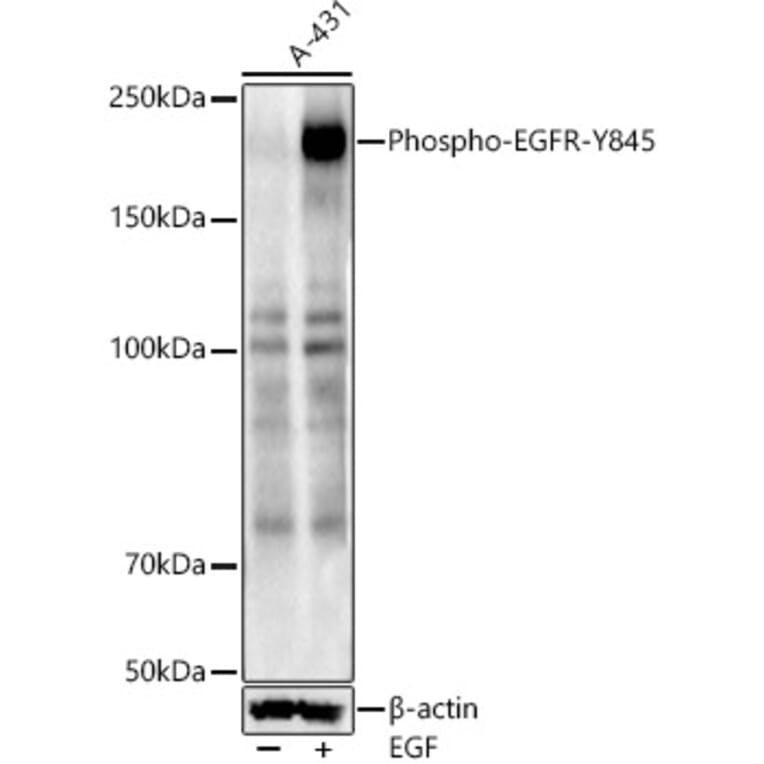 Western Blot - Anti-EGFR (phospho Tyr845) Antibody (A10871) - Antibodies.com