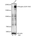 Western Blot - Anti-EGFR (phospho Tyr845) Antibody (A10871) - Antibodies.com