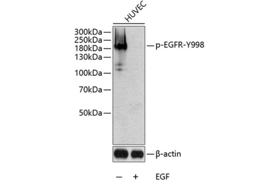 Western Blot - Anti-EGFR (phospho Tyr998) Antibody (A10872) - Antibodies.com