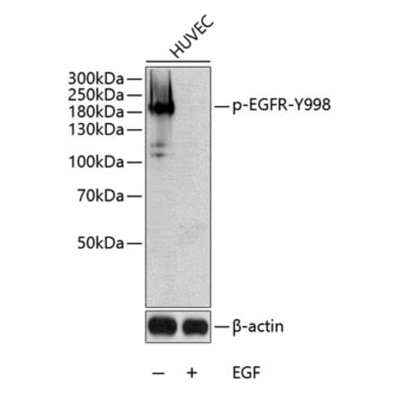 Western Blot - Anti-EGFR (phospho Tyr998) Antibody (A10872) - Antibodies.com