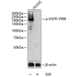 Western Blot - Anti-EGFR (phospho Tyr998) Antibody (A10872) - Antibodies.com