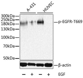 Western Blot - Anti-EGFR (phospho Thr669) Antibody (A10873) - Antibodies.com