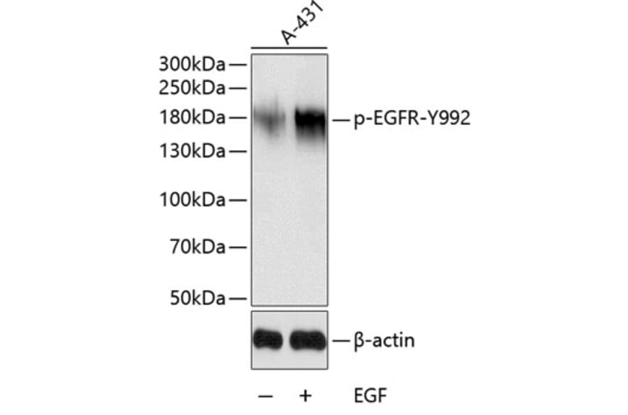 Western Blot - Anti-EGFR (phospho Tyr992) Antibody (A10874) - Antibodies.com