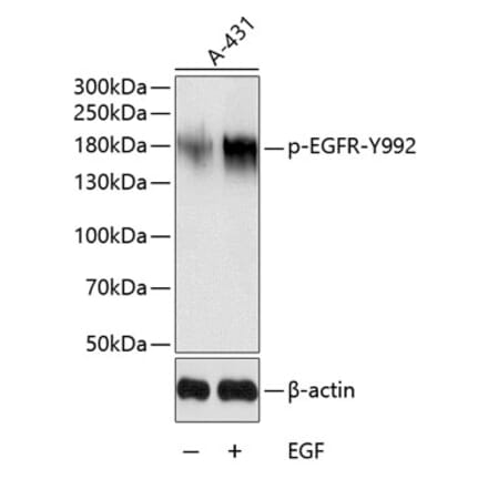 Western Blot - Anti-EGFR (phospho Tyr992) Antibody (A10874) - Antibodies.com