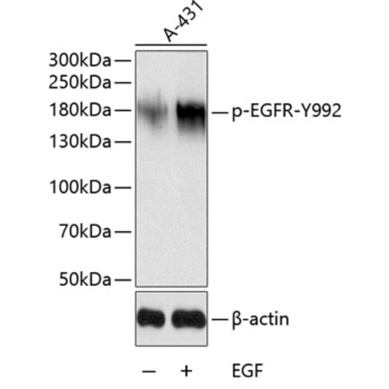 Western Blot - Anti-EGFR (phospho Tyr992) Antibody (A10874) - Antibodies.com