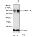 Western Blot - Anti-EGFR (phospho Tyr992) Antibody (A10874) - Antibodies.com