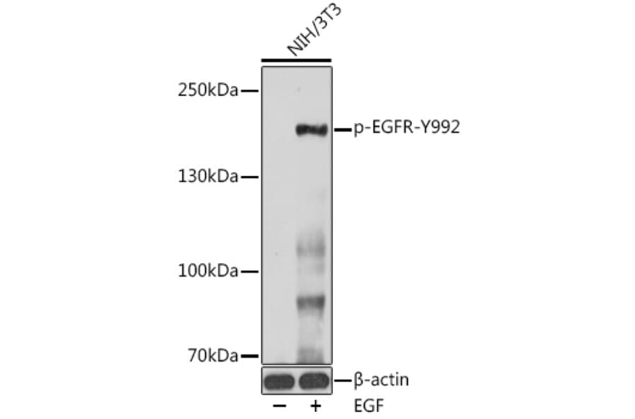 Western Blot - Anti-EGFR (phospho Tyr992) Antibody (A10874) - Antibodies.com
