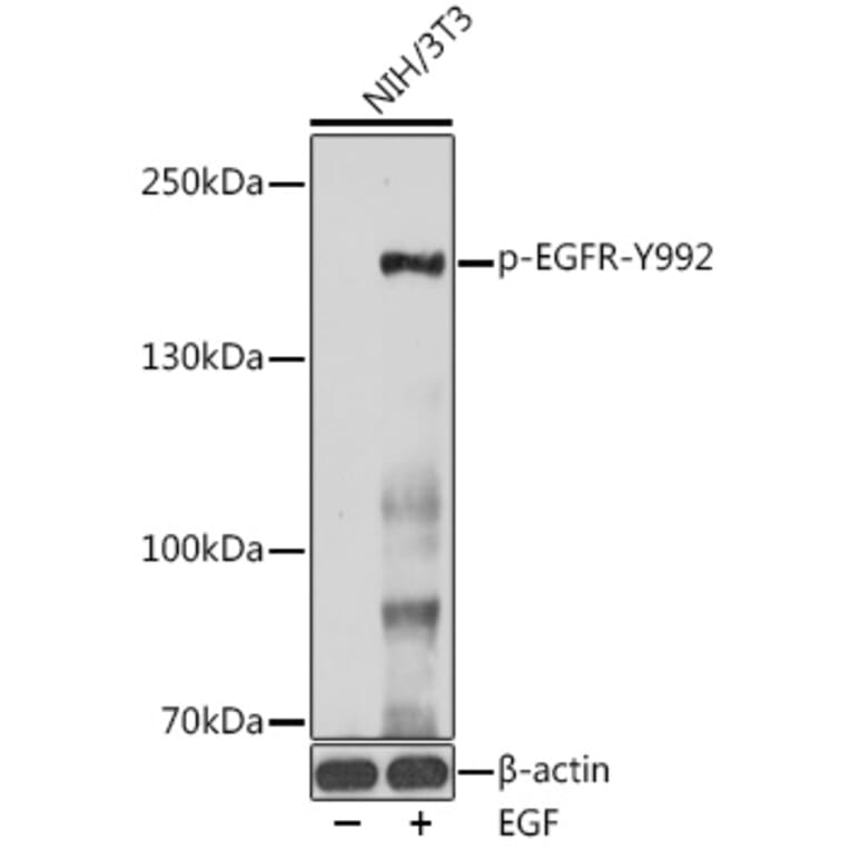 Western Blot - Anti-EGFR (phospho Tyr992) Antibody (A10874) - Antibodies.com