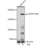 Western Blot - Anti-EGFR (phospho Tyr992) Antibody (A10874) - Antibodies.com